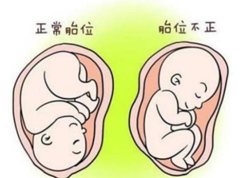 上海助孕：详述试管宝宝易早产的原因
