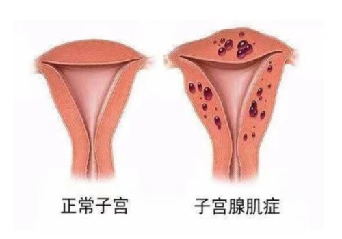 做试管打促排针是什么感觉,试管促排卵针什么时候打最好
