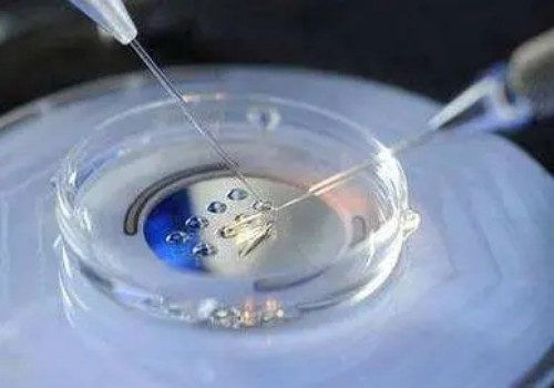 上海正规助孕机构：母乳检测结果怎么看？看这三个方面就可知道母乳怎么样