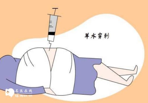 上海试管婴儿价格：染色体缺失对生育有什么影响,男性染色体缺失的原因
